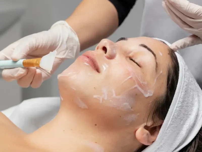 Tratamiento con Ácidos Renueva tu piel con peelings químicos